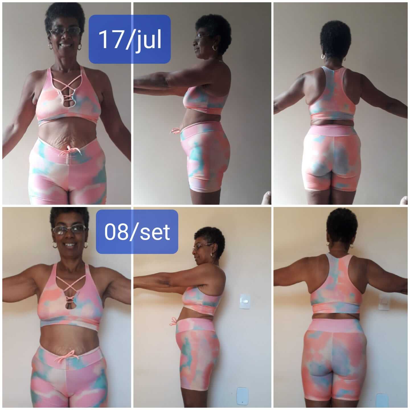 Janete - Jul 2023 e Set 2023