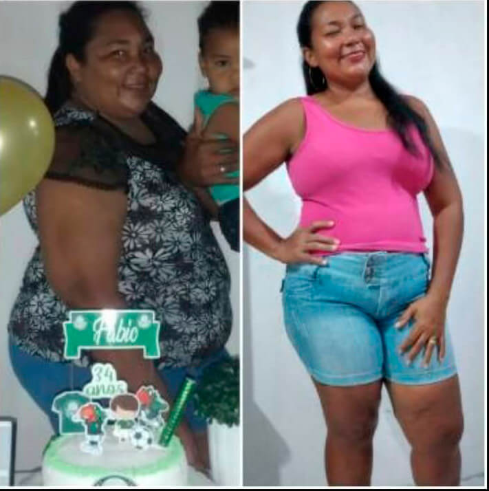 Taty - antes e depois (1)